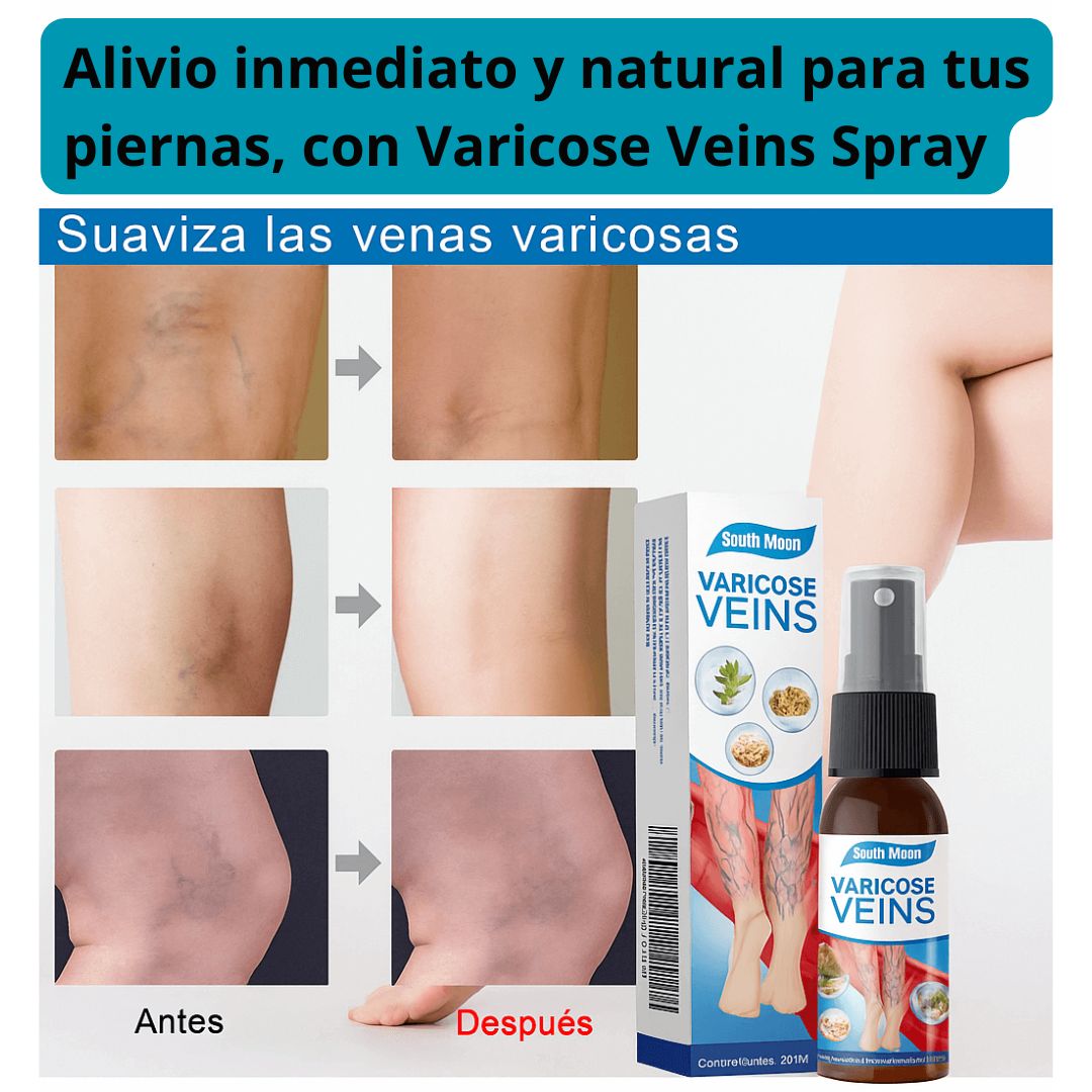 VARICOSE VEINS SPRAY