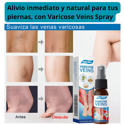 VARICOSE VEINS SPRAY