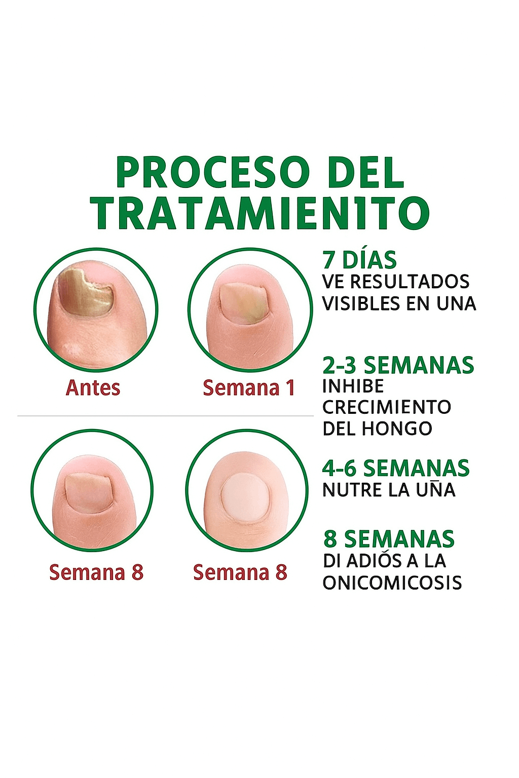 UñaSana+, Uñas libres de hongo desde la raíz, ¡en pocas semanas!