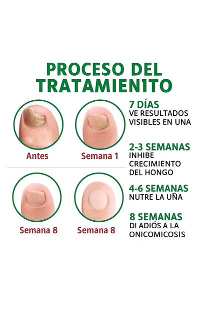 UñaSana+, Uñas libres de hongo desde la raíz, ¡en pocas semanas!