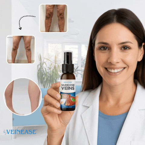 VARICOSE VEINS SPRAY